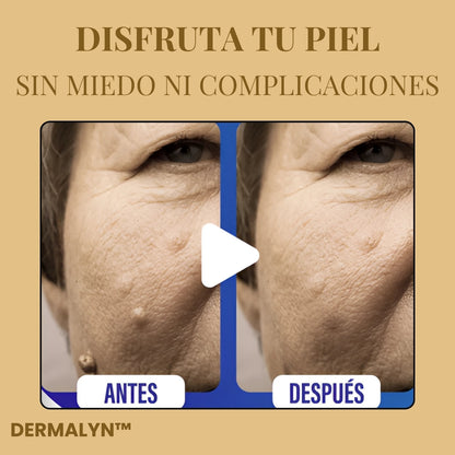 DERMALYN™ Recupera tu piel. Recupera tu seguridad.